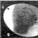 Metódy experimentálnej infekcie kuracích embryí