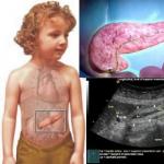 Рисков панкреас: реактивен панкреатит при деца