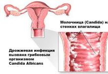 Первые признаки беременности до задержки